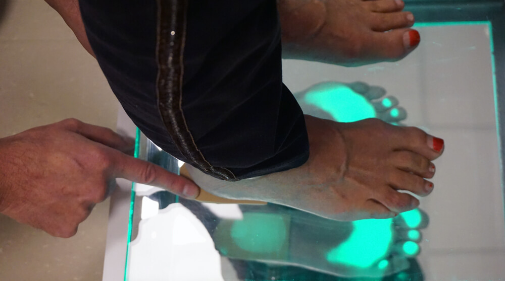 Podobaroscoop onderzoek bij Podozorg Amsterdam Podobaroscoop onderzoek bij Podozorg Amsterdam